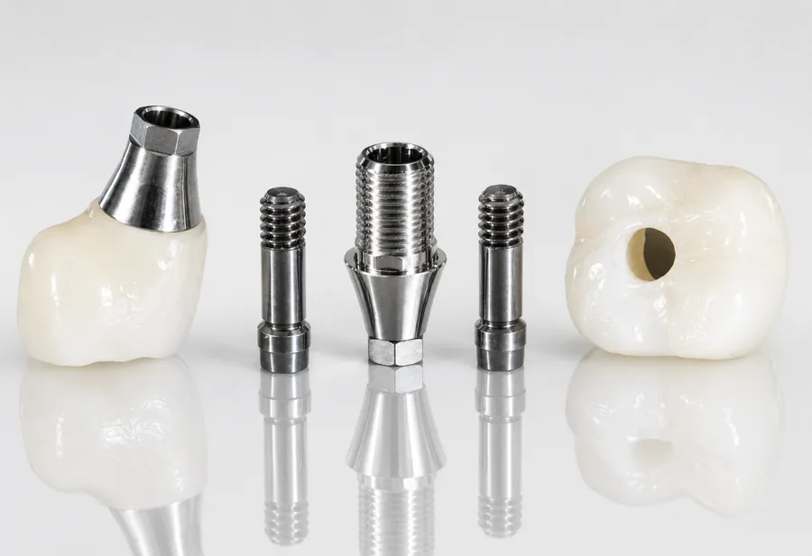 Implant restoration at Elite Smiles