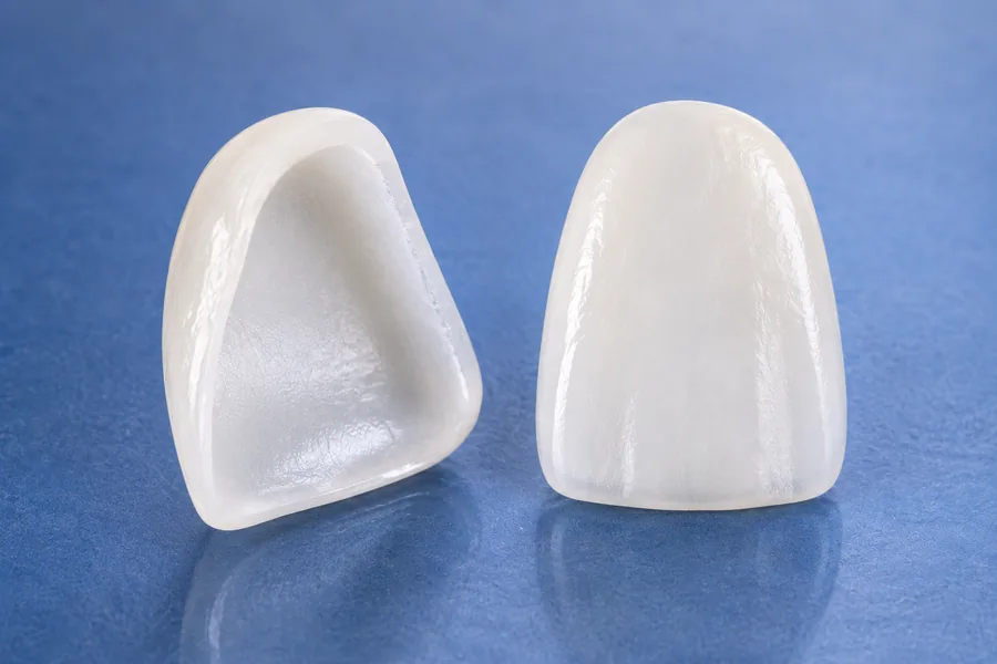 Porcelain dental veneers used to enhance the appearance of front teeth