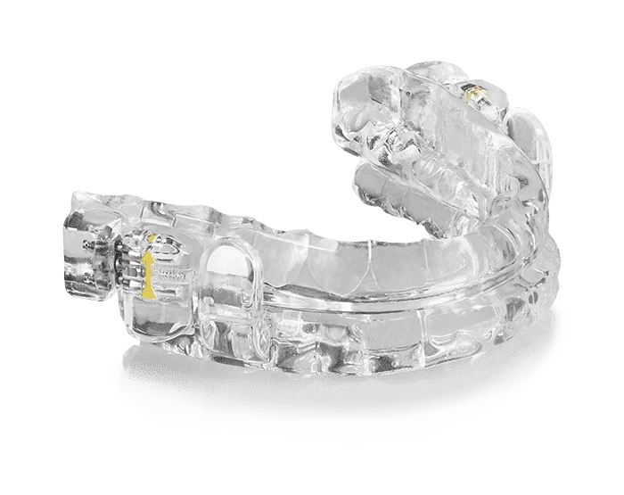 Clear oral appliance illustrating mandibular advancement therapy for sleep apnea